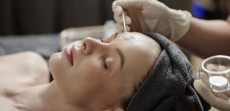 Microneedling, Chemical Peel, and RF Facial Treatments in Arlington